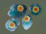 The Varicella-Zoster Viruses Is from the Herpes Family and Causes Chickenpox and Shingles