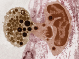 A Neutrophil  a Type of White Blood Cell Passing Through the Wall of Capillary
