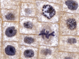 Mitosis in Onion Root Tip Cells (Allium)  Quad Stain  LM X1000