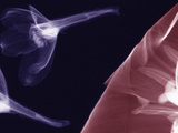 X-Ray of Clemetis and Delphinium Flowers