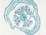 Cross-Section of the Floral Bud of Cabbage (Brassica)  LM X6