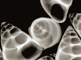 X-Ray of Caracole Sea Snail Shells
