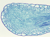 Cross-Section of Cabbage Leaf (Brassica)