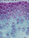 Cross-Section of a Palm Stem Showing Vascular Bundles (Chamaedorea)  a Monocot  LM X10