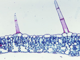 Cross-Section of a Foxglove Leaf with Trichomes (Digitalis)  LM X55