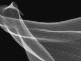 X-Ray of Calla Lily Flower Petals