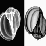 X-Ray of Mollusk Gastropod Shells