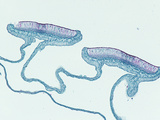 Cross-Section of a Lichen Thallus (Leptogium)  LM X10