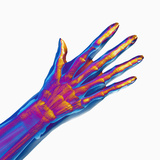 Human Hand Showing Bones and Muscles