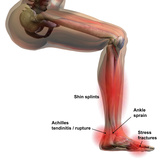 Sports Injuries of the Lower Leg and Foot  Labeled