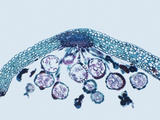 Fern Leaf Section with Sorus and Sporangia  LM X18