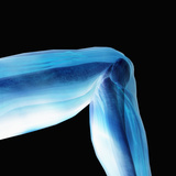 Human Knee Hinge Joint Showing Bones and Muscles