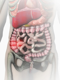 Biomedical Illustration of Inflammatory Bowel Disease (Ibd)