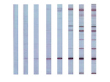 Western Blot Test Illustration