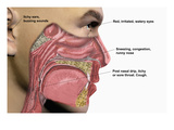 Illustration of Human Male Head Showing Mouth  Nose  and Throat Illustrating Allergy Symptoms