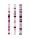 Western Blot Test Illustration
