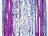 Longitudinal Section of an Older Grape Stem (Vitis)  a Dicot  LM X8