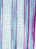 Longitudinal Section of an Older Corn Stem (Zea Mays)  a Monocot  LM X15