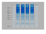 Western Blot Test Illustration