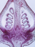 Longitudinal Section of Cotton Fruit (Gossypium)  LM X4