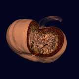 Ct of an Opened Pumpkin