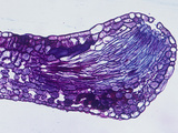 Cross-Section of a Fuchsia Showing the Hydathode or Water-Secreting Epidermal Structures  LM X40