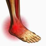 Ankle Pain  Human Ankle Showing Bones And Muscles