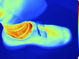 Thermogram of Man's Foot in a Shoe