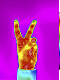 Thermogram of a Hand Showing the V Sign