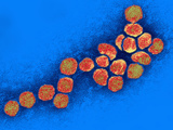 The West Nile Virus