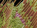 Pollen Grains in the Pollen Basket of a Bee  SEM X200