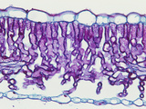 Cross-Section of an Elderberry (Sambucus) Sun Leaf  LM X65