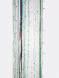 Longitudinal-Section of a Squash (Cucurbita) Stem Showing Sieve Tubes and Trichomes  LM X10