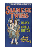 Siamese Twins