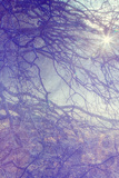 Sunbreak Through Branches  Awahnee Meadow