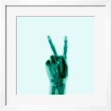 X-Ray of Hand Doing Peace Sign